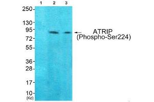 Western blot analysis of extracts from 293 cells (Lane 2) and Hela cells (Lane 3), using ATRIP (Phospho-Ser224) Antibody. (ATRIP antibody  (pSer224))