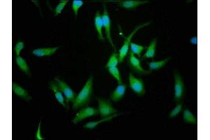 Immunofluorescence staining of Hela cells with ABIN7146628 at 1:114, counter-stained with DAPI. (CREM antibody  (AA 145-321))