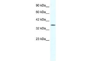 WB Suggested Anti-YBX2 Antibody Titration:  1. (YBX2 antibody  (Middle Region))