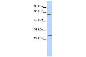 Western Blotting (WB) image for anti-Solute Carrier Family 18 (Vesicular Monoamine Transporter), Member 1 (SLC18A1) antibody (ABIN2458160) (SLC18A1 antibody)