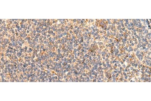 ABHD2 antibody
