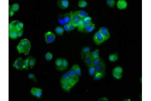 Immunofluorescence staining of MCF-7 cells with ABIN7156352 at 1:400, counter-stained with DAPI. (IGF1R antibody  (AA 763-931))