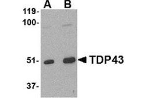 Western blot analysis of TDP43 in L1210 cell lysate with this product at (A) 0. (TARDBP antibody  (Center))