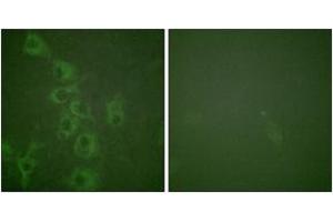 Immunofluorescence analysis of HuvEc cells, using Histamine H1 Receptor (Phospho-Ser398) Antibody. (HRH1 antibody  (pSer398))