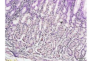 Formalin-fixed and paraffin embedded human gastric tissue labeled with Anti-Leptin Polyclonal Antibody , Unconjugated at 1:300, followed by conjugation to the secondary antibody and DAB staining (Leptin antibody  (AA 17-100))