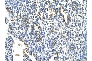 Rabbit Anti-KRT2 Antibody       Paraffin Embedded Tissue:  Human alveolar cell   Cellular Data:  Epithelial cells of renal tubule  Antibody Concentration:   4. (Keratin 2 antibody  (Middle Region))