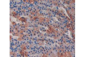 Used in DAB staining on fromalin fixed paraffin- embedded Kidney tissue (MTUS1 antibody  (AA 1020-1210))