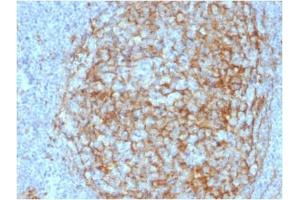 ABIN6383875 to CD14 was successfully used to stain membranes of macrophages in human lymph node and tonsil sections. (CD14 antibody  (Extracellular Domain))