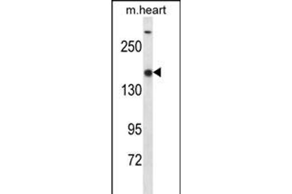 SETD1B antibody  (C-Term)