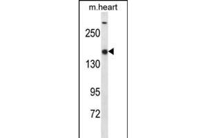SET1B Antibody (C-term) (ABIN656346 and ABIN2845645) western blot analysis in mouse heart tissue lysates (35 μg/lane). (SETD1B antibody  (C-Term))