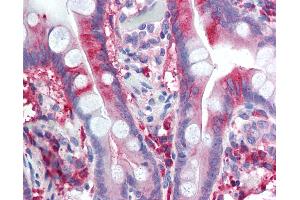 Anti-CACNA1C / Cav1. (CACNA1C antibody  (Internal Region))
