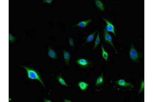 Immunofluorescent analysis of U251 cells using ABIN7143570 at dilution of 1:100 and Alexa Fluor 488-congugated AffiniPure Goat Anti-Rabbit IgG(H+L) (Afadin antibody  (AA 1663-1809))