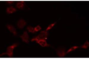 ABIN6278623 staining HepG2 by IF/ICC. (PSCA antibody)