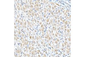 Immunohistochemistry of paraffin-embedded rat ovary using MTAP Rabbit pAb (ABIN6132365, ABIN6144119, ABIN6144120 and ABIN6214763) at dilution of 1:50 (40x lens). (MTAP antibody  (AA 1-283))