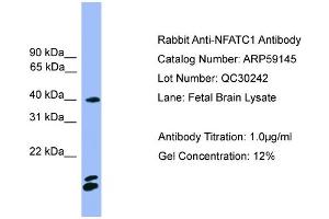 WB Suggested Anti-NFATC1  Antibody Titration: 0.