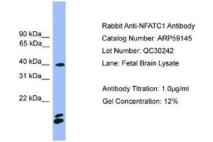 WB Suggested Anti-NFATC1  Antibody Titration: 0. (NFATC1 antibody  (N-Term))