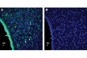 Expression of GPR18 in rat dorsomedial hypothalamus. (G Protein-Coupled Receptor 18 (GPR18) Peptide)