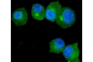 IF analysis of S100A9 using anti-S100A9 antibody (ABIN3042482).