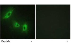 Immunofluorescence analysis of HeLa cells, using ACVR1B polyclonal antibody . (Activin A Receptor Type IB/ALK-4 antibody  (AA 73-122))