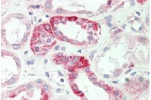 Human Kidney: Formalin-Fixed, Paraffin-Embedded (FFPE) (ADORA1 antibody  (Asp326))