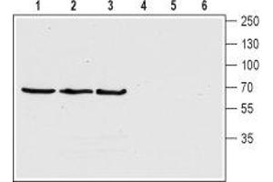 Western blot analysis of human SH-5YSY neuroblastoma cell lysate (lanes 1 and 4), rat (lanes 2 and 5) and mouse (lanes 3 and 6) brain lysates: - 1-3. (ChT antibody  (4th Extracellular Loop))
