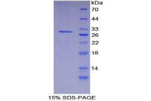 SDS-PAGE analysis of Human Integrin alpha D Protein.