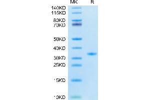 SARS-CoV-2 3CLpro (F140A) on Tris-Bis PAGE under reduced condition. (SARS-Coronavirus Nonstructural Protein 8 (SARS-CoV NSP8) (F140A) Protein)