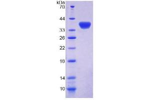 SDS-PAGE (SDS) image for Guanylate Binding Protein 4 (GBP4) (AA 1-304) protein (His tag) (ABIN6239044) (GBP4 Protein (AA 1-304) (His tag))