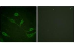 Immunofluorescence analysis of HeLa cells, using Keratin 18 (Phospho-Ser33) Antibody. (Cytokeratin 18 antibody  (pSer34))
