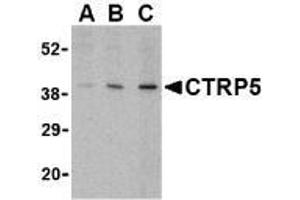 Western blot analysis of CTRP5 in caco-2 cell lysate with AP30255PU-N CTRP5 antibody at (A) 1, (B) 2, and (C) 4 μg/ml. (CTRP5 antibody  (Intermediate Domain))