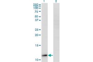 Western Blot analysis of RPP14 expression in transfected 293T cell line by RPP14 monoclonal antibody (M01A), clone 3H4. (RPP14 antibody  (AA 1-75))