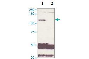 5 mg of the whole cell lysate derived from conditioned LNCaP were immunoprecipitated by 4 ug of AR (phospho S210) polyclonal antibody (Cat # PAB12654, lane 1) or pre adsorbed by immunization peptide (lane 2) followed by AR polyclonal antibody  at 1 : 500. (Androgen Receptor antibody  (pSer210))