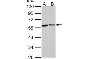 WB Image FKBP4 antibody detects FKBP4 protein by Western blot analysis. (FKBP4 antibody  (Center))