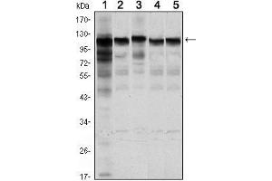 Western Blot showing HK1 antibody used against Jurkat (1), Hela (2), HepG2 (3), MCF-7 (4) and PC-12 (5) cell lysate. (Hexokinase 1 antibody)