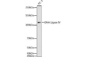 Western blot analysis of extracts of PC-3 cells, using DNA Ligase IV antibody (ABIN3022474, ABIN3022475, ABIN3022476 and ABIN6218843) at 1:1000 dilution. (LIG4 antibody  (AA 612-911))