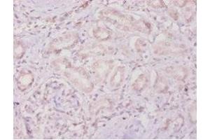 Immunohistochemistry of paraffin-embedded human kidney tissue using ABIN7159497 at dilution of 1:100 (TIMP4 antibody  (AA 31-224))