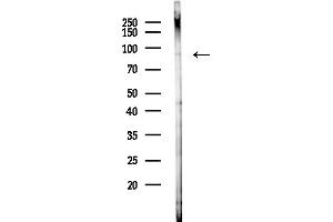 anti-Squamous Cell Carcinoma Antigen Recognized By T Cells (SART1) (C-Term) antibody
