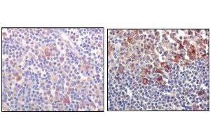 Immunohistochemical analysis of paraffin-embedded human lymph-node tissues (left) and human lymph follicle tissues (right), showing cytoplasmic and membrane localization using BTK mouse mAb with DAB staining.