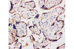 Immunohistochemistry (IHC) image for anti-WNT1 Inducible Signaling Pathway Protein 1 (WISP1) (AA 354-367), (C-Term) antibody (ABIN3043974)