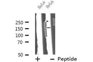Western blot analysis of ZFYVE9 using HeLa whole cell lysates (ZFYVE9 antibody  (C-Term))