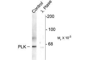 Image no. 1 for anti-Polo-Like Kinase 1 (PLK1) (pThr210) antibody (ABIN372703) (PLK1 antibody  (pThr210))