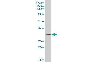 VNN3 polyclonal antibody (A01), Lot # 060703JCS1 Western Blot analysis of VNN3 expression in MES-SA/Dx5 . (VNN3 antibody  (AA 175-274))