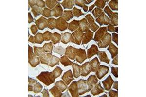 Immunohistochemistry analysis in formalin fixed and paraffin embedded human skeletal muscle reacted with ORMDL2 Antibody (Center) Cat. (ORMDL2 antibody  (Middle Region))