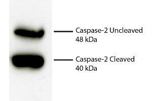 Total cell lysates from Jurkat cells were incubated with Rabbit Anti-Human DR5-UNLB secondary antibody and chemiluminescent detection. (Caspase 2 antibody)