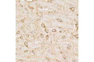 Immunohistochemistry of paraffin-embedded rat brain using MK4 Rabbit mAb (ABIN7268653) at dilution of 1:50 (40x lens). (MAP3K4 antibody)