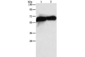 Western Blot analysis of HepG2 cell and Human placenta tissue using Placental Alkaline Phosphatase Polyclonal Antibody at dilution of 1:1450 (PLAP antibody)