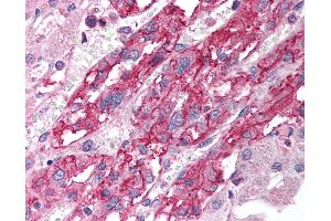 Anti-SLC18A1 / VMAT1 antibody IHC of human adrenal. (SLC18A1 antibody  (AA 103-152))