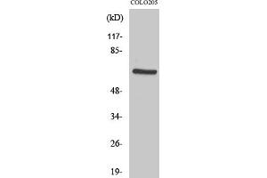 Western Blotting (WB) image for anti-3-phosphoinositide Dependent Protein Kinase-1 (PDPK1) (Ser241) antibody (ABIN5955651) (PDPK1 antibody  (Ser241))
