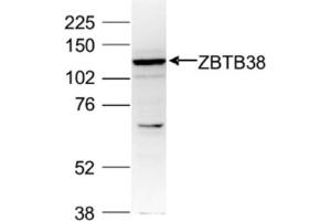 Western Blot of anti-ZBTB38 antibody Western Blot results of Rabbit anti-ZBTB38 antibody. (ZBTB38 antibody  (C-Term, Internal Region))