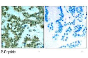 Image no. 1 for anti-Protein Kinase C, theta (PRKCQ) (pSer676) antibody (ABIN197070) (PKC theta antibody  (pSer676))